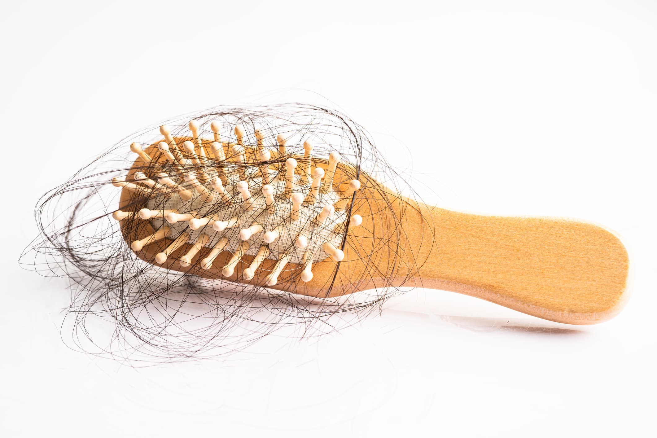 Crack the code of hairloss